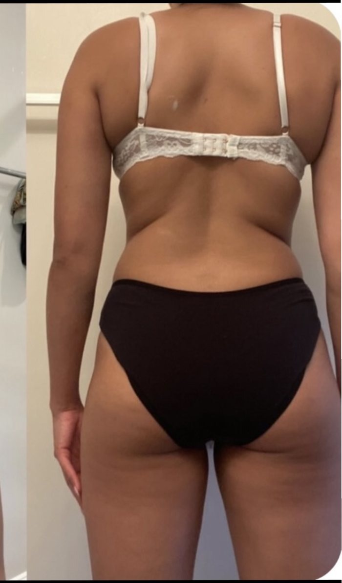 Before — Transformation 3